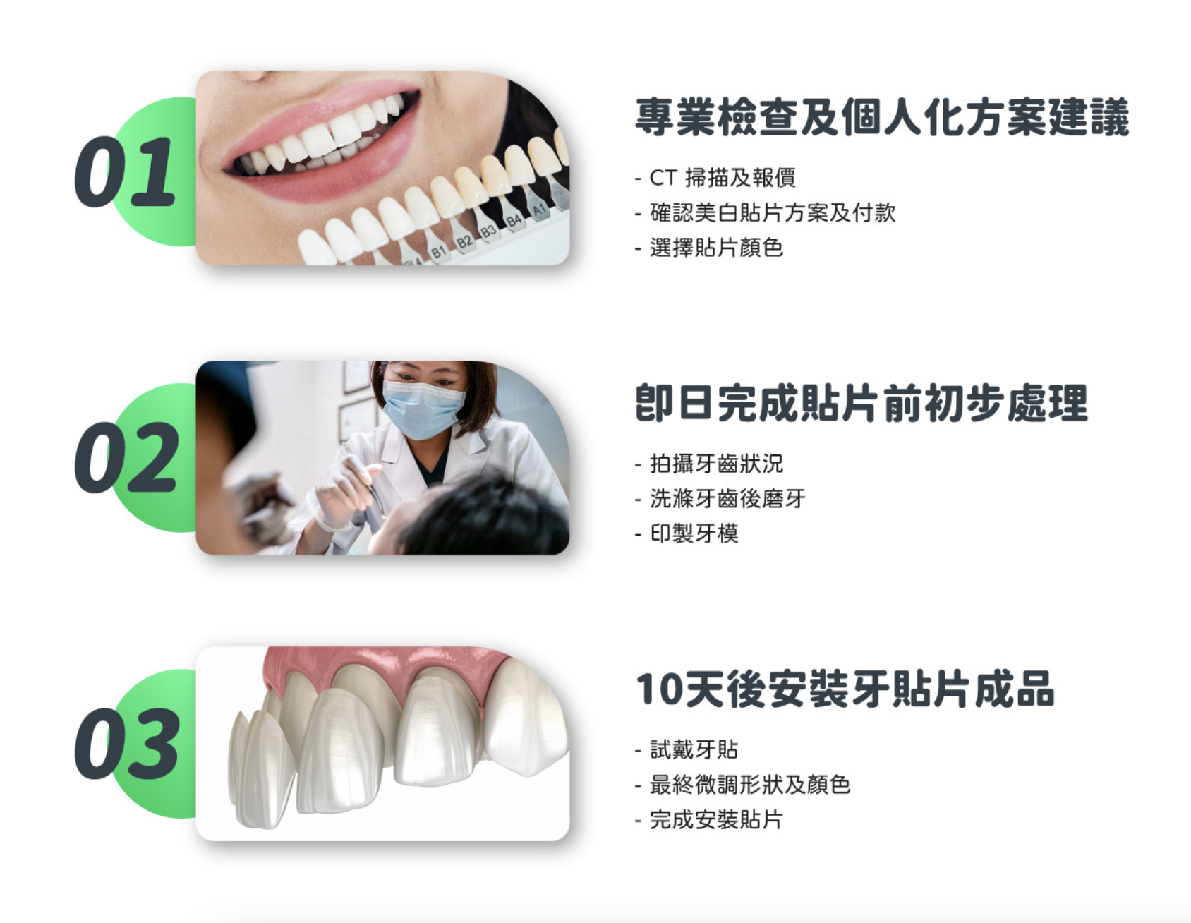 牙齒貼面過程